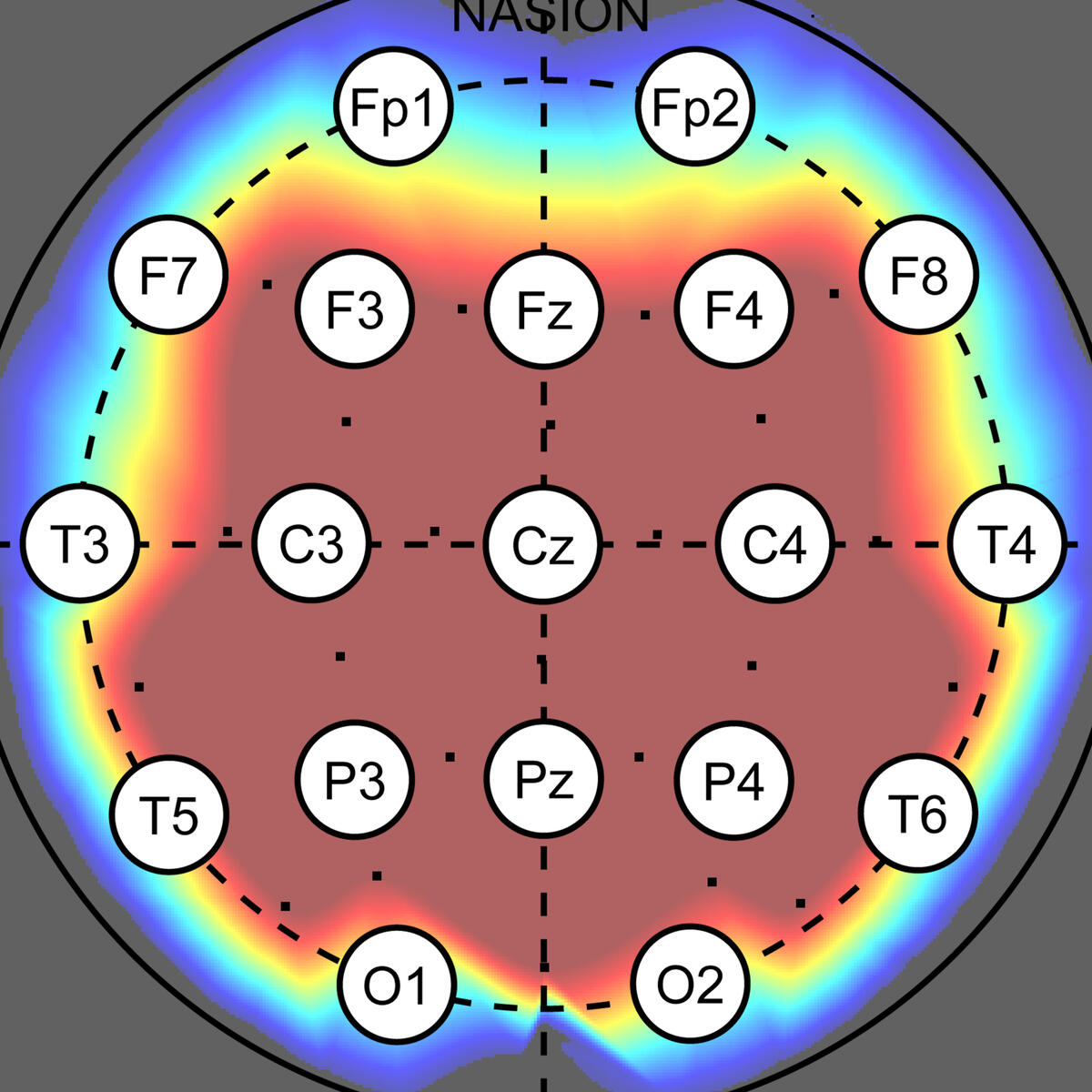 An image of brain analysis result.