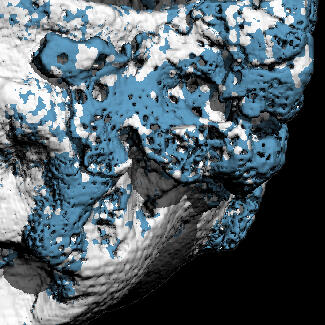 An image of bone analysis result.