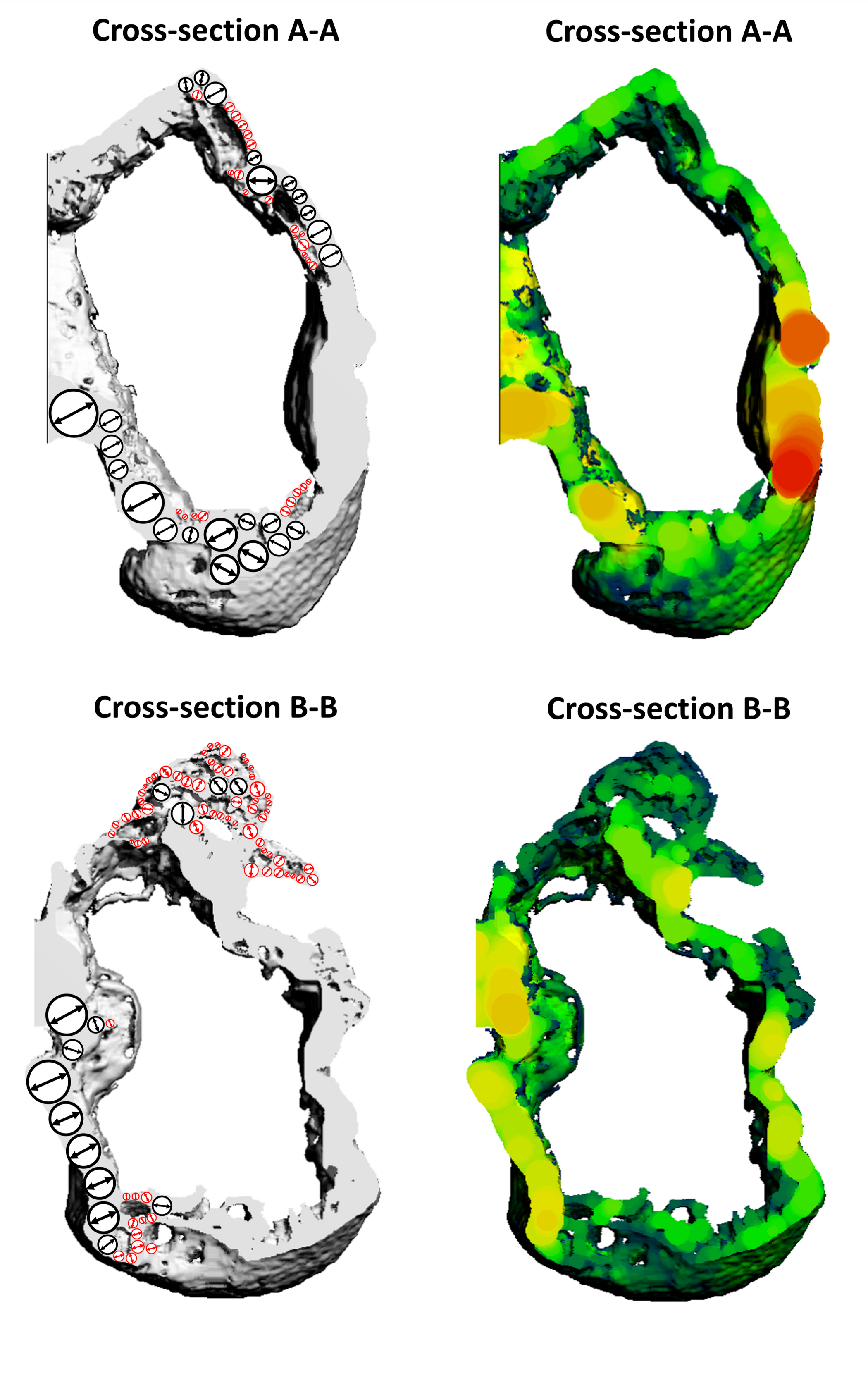 An diagram detailing an algorithm for bone structural analysis.